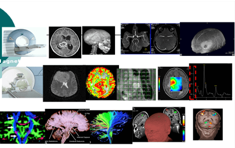 עלות MRI פרטי בדיקת MRI פרטית