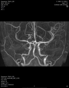 MRI אנגיוגרפיה