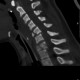 MRI ו CT עמוד שדרה