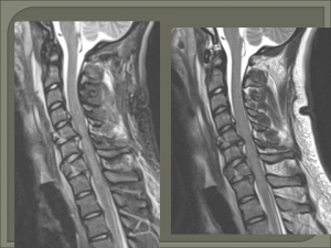 CT ו MRI צווארי