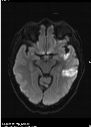 mri test of 59 year old