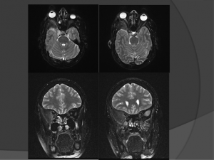 סריקות MRI וCT