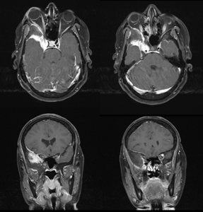 mri and ct scans