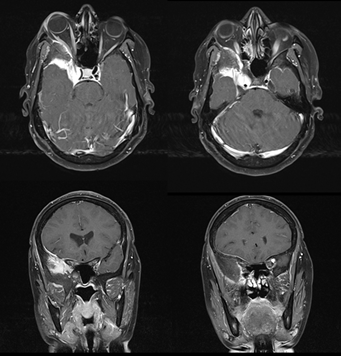 mri and ct scan 2